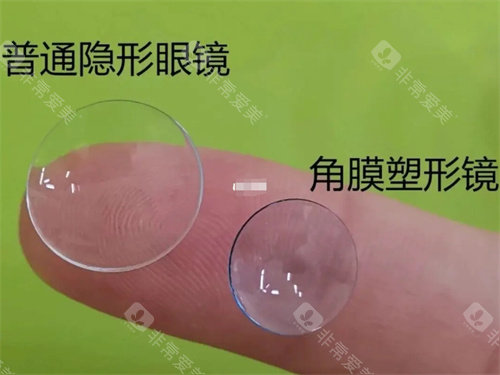 普通隐形眼镜和角膜塑形镜的对比图