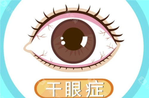 干眼症眼球照片