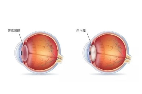 南通大学附属医院眼科挂号预约，电话号码预约、微信预约、到院预约挂号流程