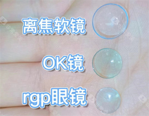 离焦软镜和OK镜以及rgp眼镜