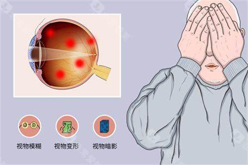 重庆治疗眼底病的医院哪家好？2025年特色眼科机构推荐与选择指南！