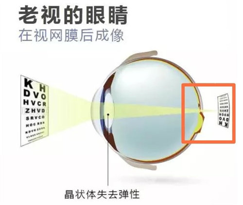 老花眼图片 老花眼图片