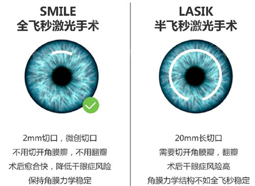 江山近视手术价格表一览，全飞秒15000元起/半飞秒12000元起/ ICL晶体植入27800元起！