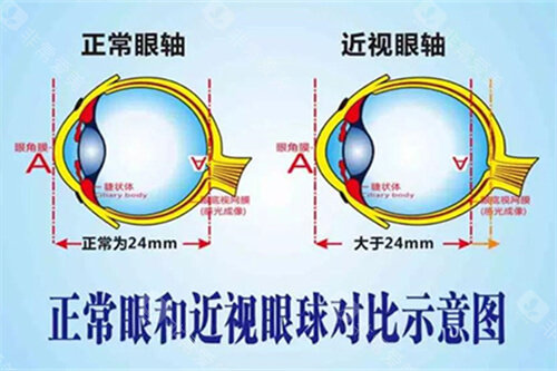 观音桥爱尔眼科怎么走？超详细路线指南来啦！