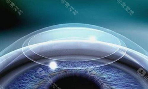 甘肃省人民医院眼科电话号码，在线联系客服预约近视、白内障等手术