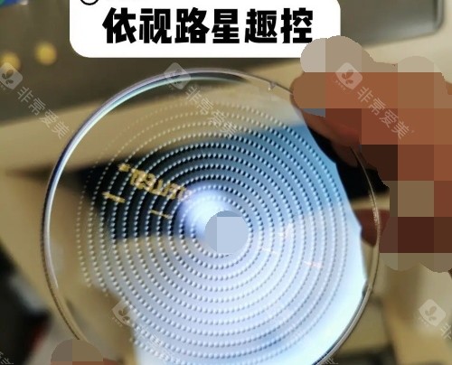 法国依路视星趣控 法国依路视星趣控