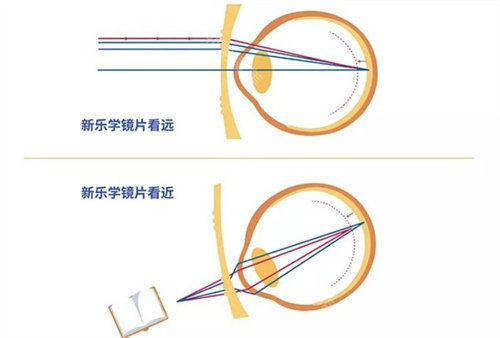 青少年用豪雅还是蔡司好?近视度数＜600度/预算≤1500元/需频繁运动选哪个?