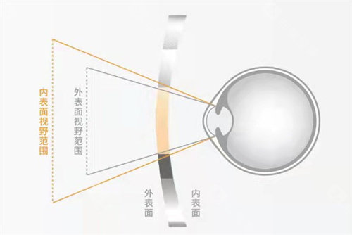 轻松控pro涨度数免费更换吗?售后政策全解析，这些条件必知！
