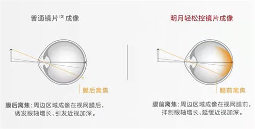 明月轻松控镜片成像