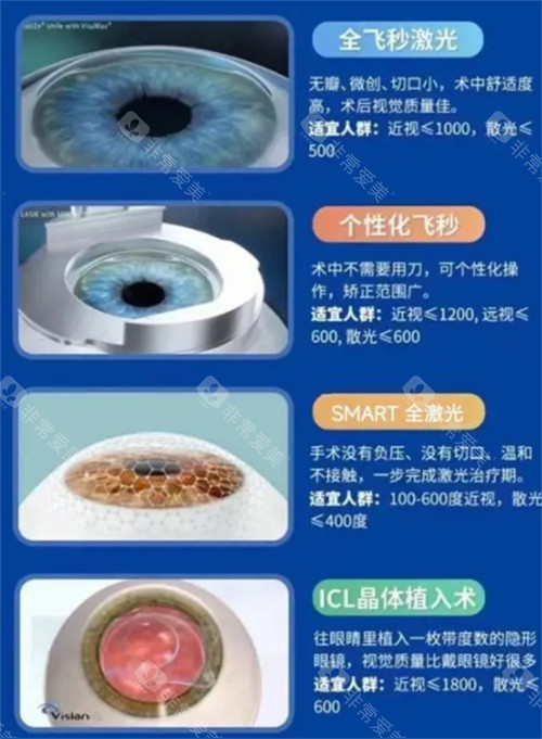 不同近视手术类型适宜人群图解