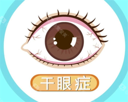 干眼症照片