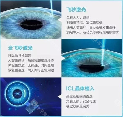 成都晴彩眼科医院做近视手术好吗?好!邓应平医生做近视又好又快!