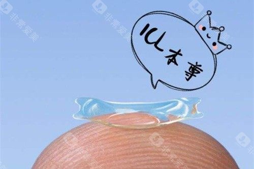 近视眼手术示意图