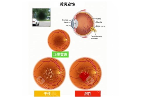 石家庄眼科医院霍爱莉医生简介:预约老年性黄斑变性手术可找他!