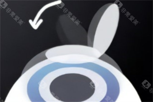301海南医院眼科收费标准公布，近视手术12800起/白内障4500起/青光眼3600起！