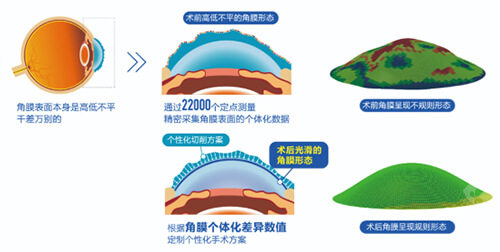 爱尔眼科需要提前挂号吗？周末节假日一般都是很建议大家提前预约挂号！
