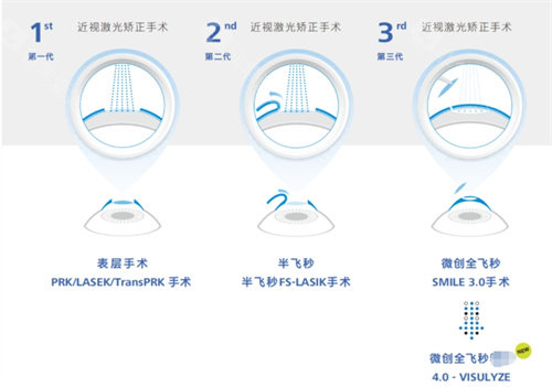 全飞秒4