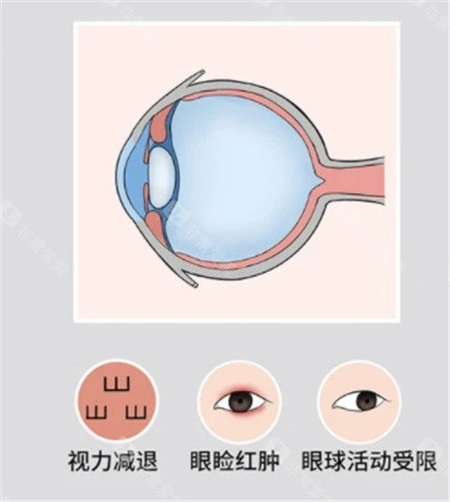眼球突出照片