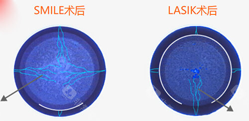 连云港市眼科医院价格表大揭秘！近视手术9k起、配镜300+、白内障手术5k+ 