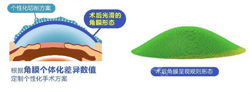 正规眼科医院价格表查询:全飞秒近视手术1.68W元起,白内障3000元起,青光眼6000元起...