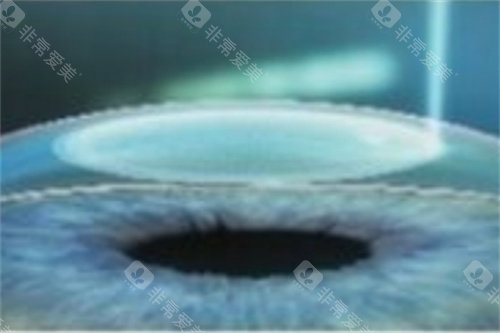 昆明润城普瑞眼科简介藏着哪些信息？地址和预约方式也帮你整理好了