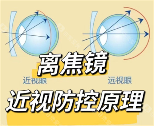 离焦镜片防控原理