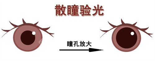 散瞳验光