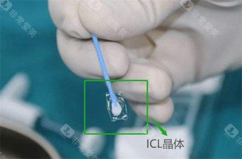ICL晶体植入手术宣传
