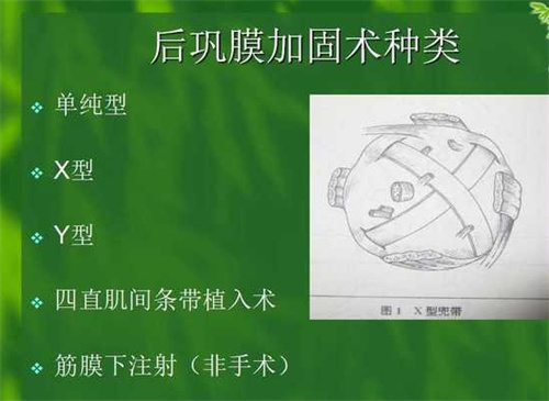 北京熙仁眼科医院挂号预约怎么挂?官网平台/电话预约/到院预约挂号方式流程公布！