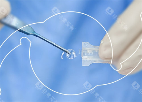 强生ICB00晶体实物取出