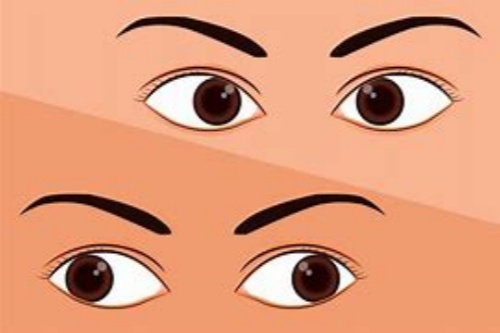 北京同仁医院付晶团队谁看的好？北京同仁医院付晶团队有哪些医生？