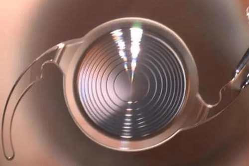网选北京同仁眼科腻害的大夫排名榜一览！公布北京同仁眼科医院医生出诊表及简介名单！