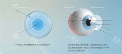 离焦软镜设计原理图