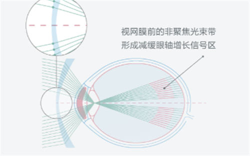 求问依视路离焦镜片多少钱一副？ 2025价格：星趣控3980元起，成长乐2980元起（含镜架）！