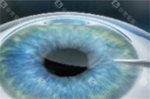 全飞秒分离基质层