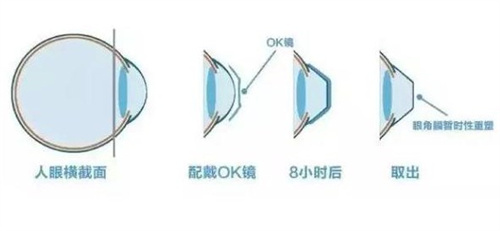 河源诗卓拉眼科地址-电话号码-简介-特色优势-口碑评价分享！