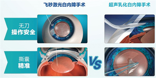 遵义市白内障眼科医院哪家好？被网友强烈推荐的医院是遵义恒爱眼科！