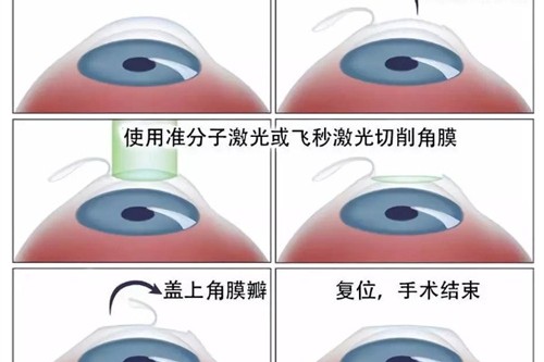 遵义医学院眼科如何挂号预约？微信、电话、现场三种方式详解与抢号技巧！
