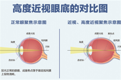 庞辰久在别的医院手术吗？在郑州尖峰眼科坐诊及手术,分享庞辰久医生坐诊时间及收费价格表！