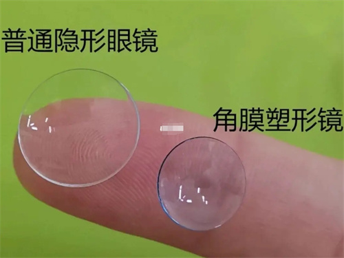 合肥科大眼科治疗近视怎么样？合肥科大眼科哪个医生好看近视眼好？