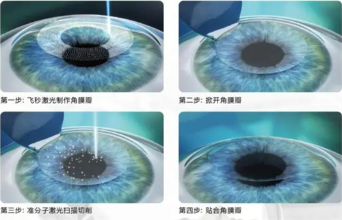 科大眼科预约不上怎么办？合肥中科大眼科网上预约挂号攻略来了
