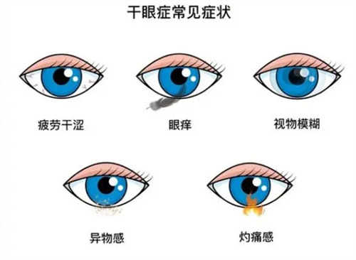 干眼症手术怎么做？3种常见术式详解，术后有望治好，告别干眼困扰