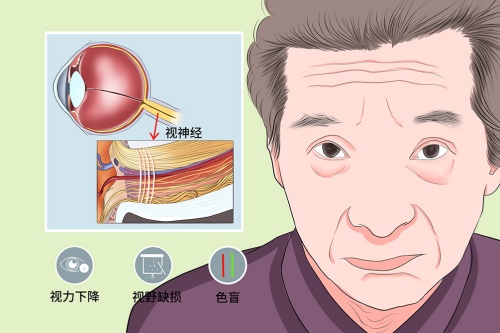 网选北京治疗视神经萎缩好医院的排名：玛林顺潮眼科、爱尔英智眼科、熙仁眼科口碑好！