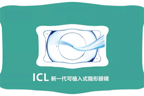 西安四院眼科地址路线院区详解：两院区地址路线全攻略，大差市院区交通便利，航天城院区屈光特色，术前检查预约指南。