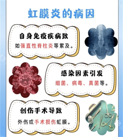 虹膜炎的病因