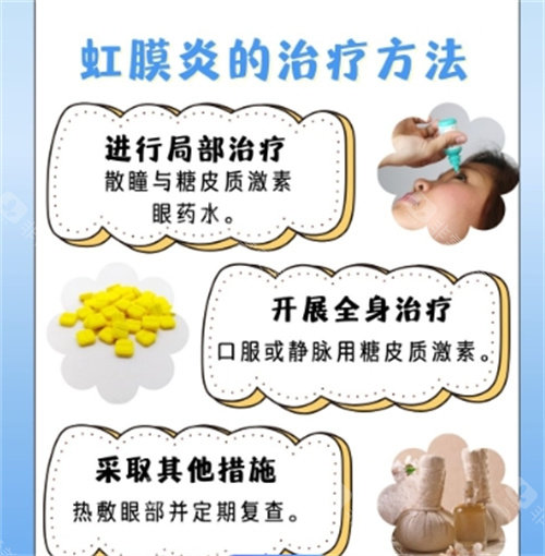 虹膜炎的治疗方法细节图