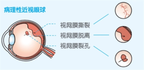 湘雅二医院的眼科门诊在哪栋楼看？五官科楼一楼3、4、5窗口可以挂号！