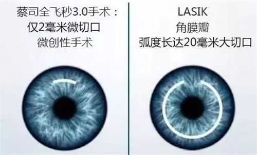 吉林看眼科好的医院有哪些？这3家必须提名：连锁机构+公立强科，口碑看得见！
