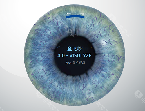 蔡司全飞秒4.0