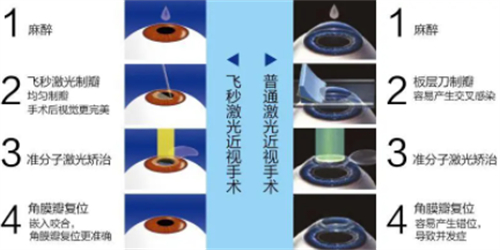 北京朝聚眼科和民众眼科医院哪家好?均位于朝阳区,点击看项目_收费_环境对比!